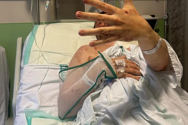 乌尔达事故幸存者忆述：被列车甩出座位，亲眼目睹妹妹遇难